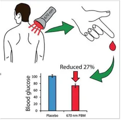 新研究发现用纳米红光照射背部可降低血糖水平