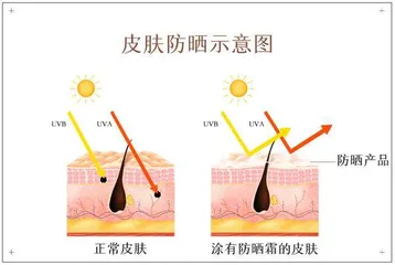 与“敏感肌”的和解之道8