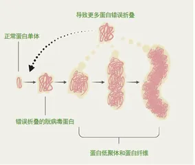 双面朊病毒4