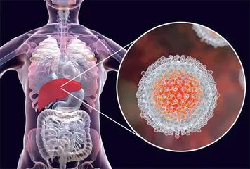 追踪丙型肝炎病毒