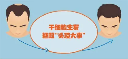 头发里的科学3