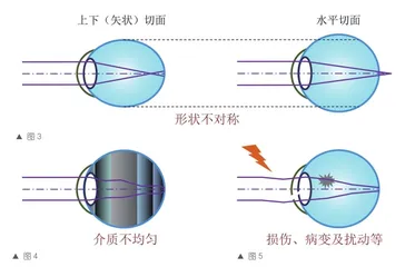 美好生活，离不开能看见美的视力4