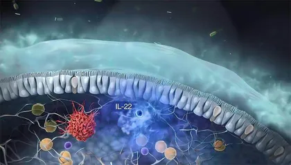 利学预防　助你远离淋巴瘤