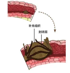 白桦在树林深处“眨眨眼”1