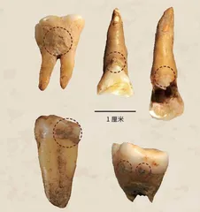 古代生物消化系统“三剑客”牙结石、胃容物和粪便化石里的秘密0