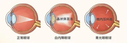 眼波流转间的微观宇宙1