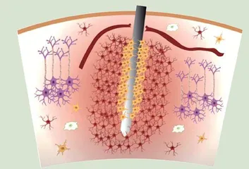 细胞医生纳米级电子设备2