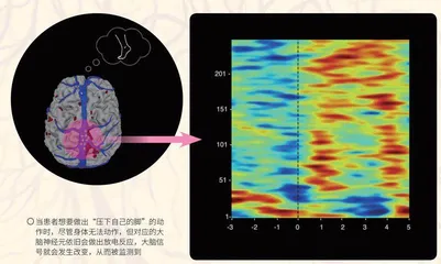 让意识发声：脑机接口技术5