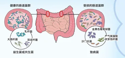 挑食的肠道微生物3