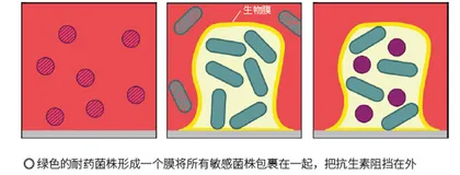 与抗生素过招的百变细菌2