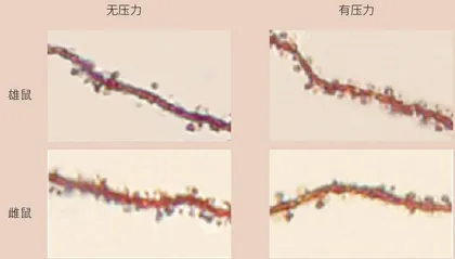 人类大脑分男女吗?3