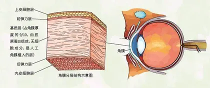 让盲人恢复视力的猪皮1