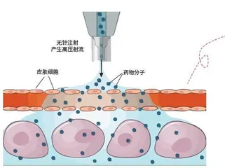 打针也温柔