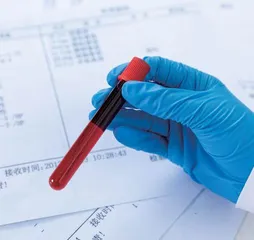 血液干细胞首次培育成功