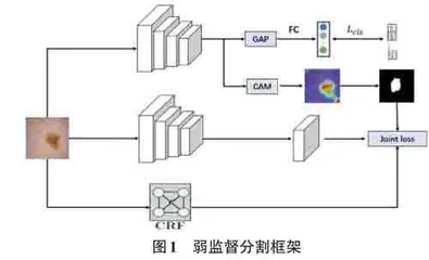 基于注意力机制的弱监督黑色素瘤图像分割研究0