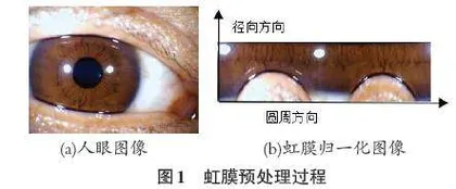 虹膜肠环图像分类方法研究