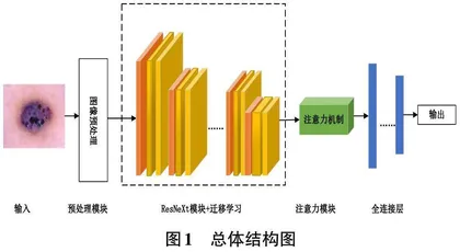 基于改进ResNeXt的黑色素瘤识别算法