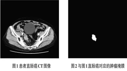 基于U-Net的直肠癌CT图像分割系统的设计与实现