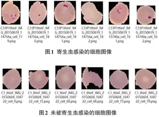 基于深度学习的人血涂片图片疟疾分类识别技术研究0