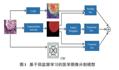 基于弱监督学习的医学图像分割方法研究