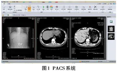 信息化对医院现代化建设的作用分析