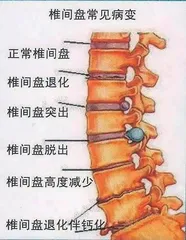 选择有时伤脑筋1