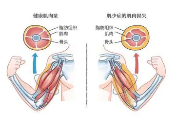 千金难买老来瘦谬矣1