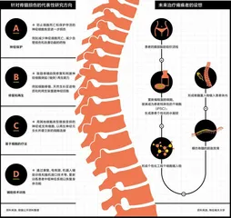 一副3D打印的脊髓，或可让瘫痪者重新行走